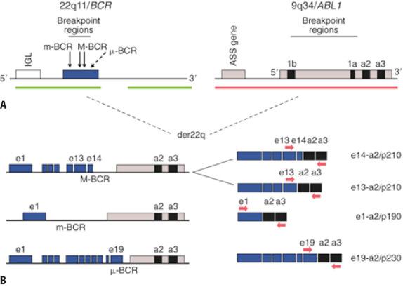 FIG. 24.3, The t(9;22)/ BCR-ABL1 abnormality.