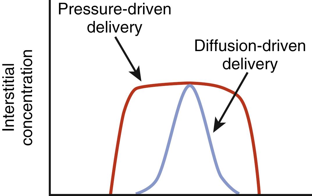 FIGURE 108.1, Convection-enhanced delivery of drug.