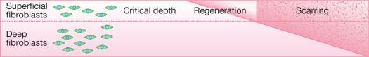 Fig. 45.2, Injury below a critical depth in skin leads to scarring.