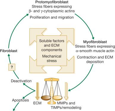 Fig. 45.3, Schematic illustration showing the evolution of the (myo)fibroblast phenotype. The myofibroblast modulation of fibroblastic cells begins with the appearance of the proto-myofibroblast, whose stress fibers contain only β- and γ-cytoplasmic actins and evolves, but not necessarily always, into the appearance of the differentiated myofibroblast, the most common variant of this cell, with stress fibers containing α-smooth muscle actin. Myofibroblasts present a well-developed rough endoplasmic reticulum and are responsible for (excessive) deposition of extracellular matrix (ECM); they also secrete matrix metalloproteinases (MMPs) and tissue inhibitors of metalloproteinases (TIMPs) and are involved in granulation tissue remodeling. Soluble factors, particularly transforming growth factor-β1, associated with ECM components (e.g., fibronectin ED-A), play important roles during myofibroblast differentiation. Mechanical stress is also importantly involved in myofibroblast differentiation. The myofibroblast can undergo apoptosis; the deactivation leading to a quiescent phenotype has not been clearly demonstrated at least in vivo.