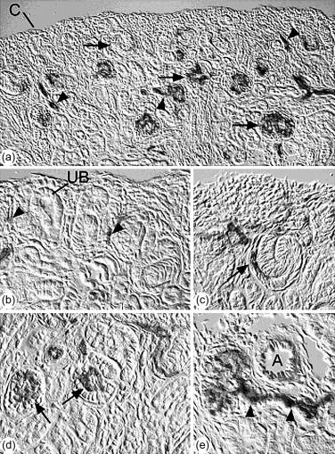 Figure 26.1, Sections of developing kidney from a heterozygous Flk1/LacZ transgenic mouse.