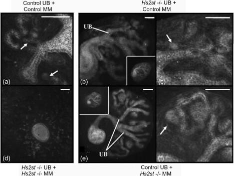 Figure 25.10, (a–f) Confocal photomicrographs of mix-and-match recombination cultures between heparan sulfate 2-O-sulfotransferase (Hs2st) knockout and control tissues. E-cadherin staining reveals epithelial structures derived from either ureteric bud (UB) or metanpehric mesenchyme (arrows). Mutual induction can be seen in co-cultures of control tissues recombined with control (a) or Hs2st −/− tissues (b), (c), (e), (f). Recombination of UB and MM from Hs2st −/− kidneys results in no mutual induction (d) (Scale bars: 100 μm).