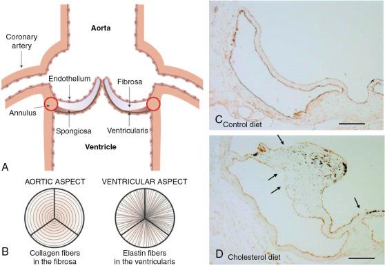 Fig. 3.1, The Normal Aortic Valve.