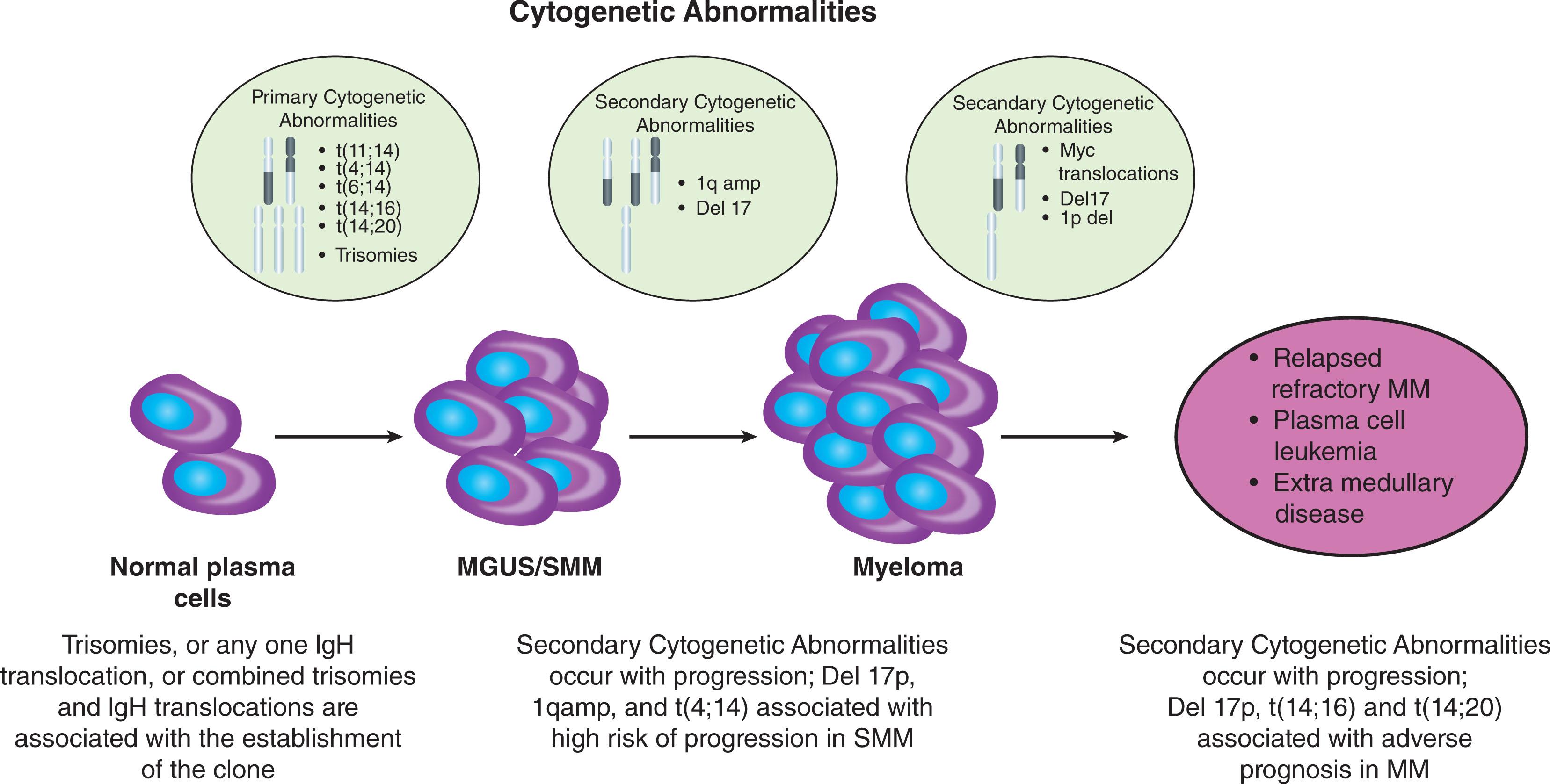 Figure 90.1, PATHOGENESIS OF MONOCLONAL GAMMOPATHIES.