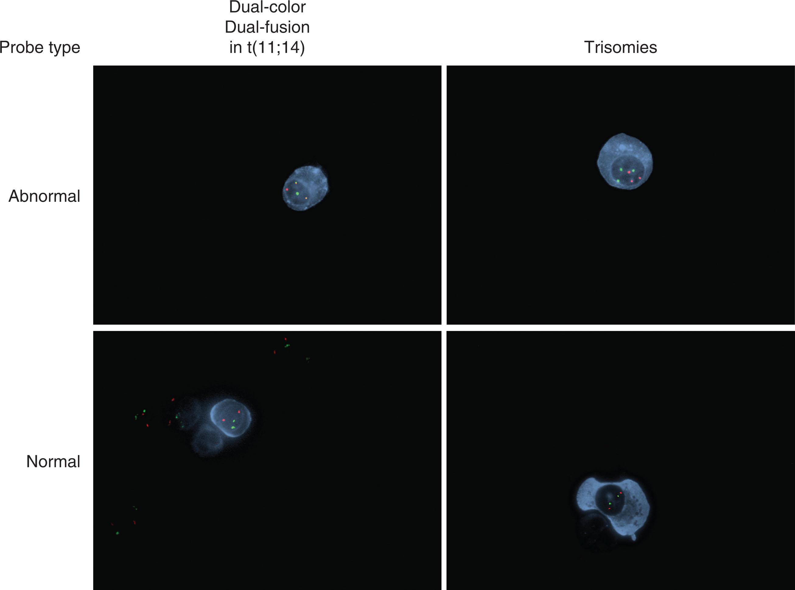 Figure 90.3, FLUORESCENT IN SITU HYBRIDIZATION (FISH).