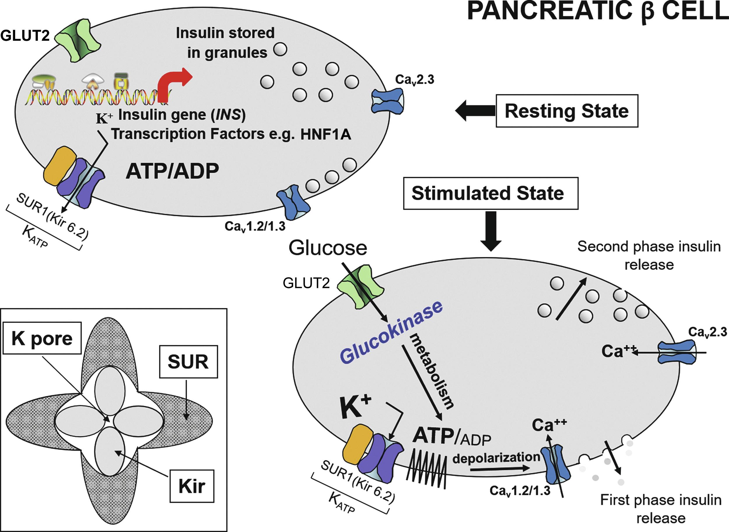 Fig. 10.1, Schematic representation of the role of K ATP channels in nutrient regulation of insulin secretion. In the resting (nonfed) state, depicted in the upper left panel, insulin synthesis and storage are regulated by transcription from the insulin gene ( INS ) and by transcription factors, such as hepatocyte nuclear factor 1 α ( HNF1A ); mutations in INS or HNF1A , as well as many other beta cell genes can cause maturity-onset diabetes of the young (MODY) or transient or permanent neonatal diabetes mellitus (NDM). The K ATP channel is composed of four subunits of the inward rectifying potassium channel 6.2 (Kir 6.2) encoded by the KCNJ11 gene on chromosome 11 and four regulatory subunits of sulfonylurea receptor 1 (SUR1), encoded by the ABCC8 gene, also located on chromosome 11 ( inset lower left ). In the fasting nonfed state, the K ATP channel remains open. However, in the stimulated (fed) state ( panel lower right ) glucose concentration increases and enters the beta cell in a concentration-dependent, but insulin-independent manner via the GLUT2 glucose transporter encoded by the gene SLCA2A . Glucokinase (GCK) phosphorylates glucose to G6P and its metabolism generates ATP. The resultant change in ATP:ADP causes closure of the K ATP channel, accumulation of intracellular potassium, membrane depolarization, leading to opening of voltage-gated calcium channels and secretion of stored insulin, as depicted in the lower right panel. Metabolism of amino acids, such as glutamate, also generates ATP, which stimulates insulin secretion as described for glucose. The amino acid leucine acts as an allosteric stimulus to glutamate dehydrogenase (GDH), which enables metabolism and generation of ATP. Activating mutations of the K ATP channel maintain it in an open state to varying degrees, in spite of ATP generation, therefore preventing insulin secretion, which leads to diabetes mellitus, including NDM. Inactivating mutations in K ATP genes prevent normal channel opening, maintaining varying degrees of channel closure, and hence constant insulin secretion that causes hyperinsulinism (see Chapters 7 and 23 ). ADP , Adenosine diphosphate; ATP , adenosine triphosphate; Ca ++ - , glucose transporter 2; K ATP , ATP-regulated potassium channel; HNF1A , hepatocyte nuclear factor 1 α alpha; INS , insulin gene; K + , potassium; Kir6 .2, potassium inward rectifying channel family6 subtype2; SUR1 , sulfonylurea receptor1.