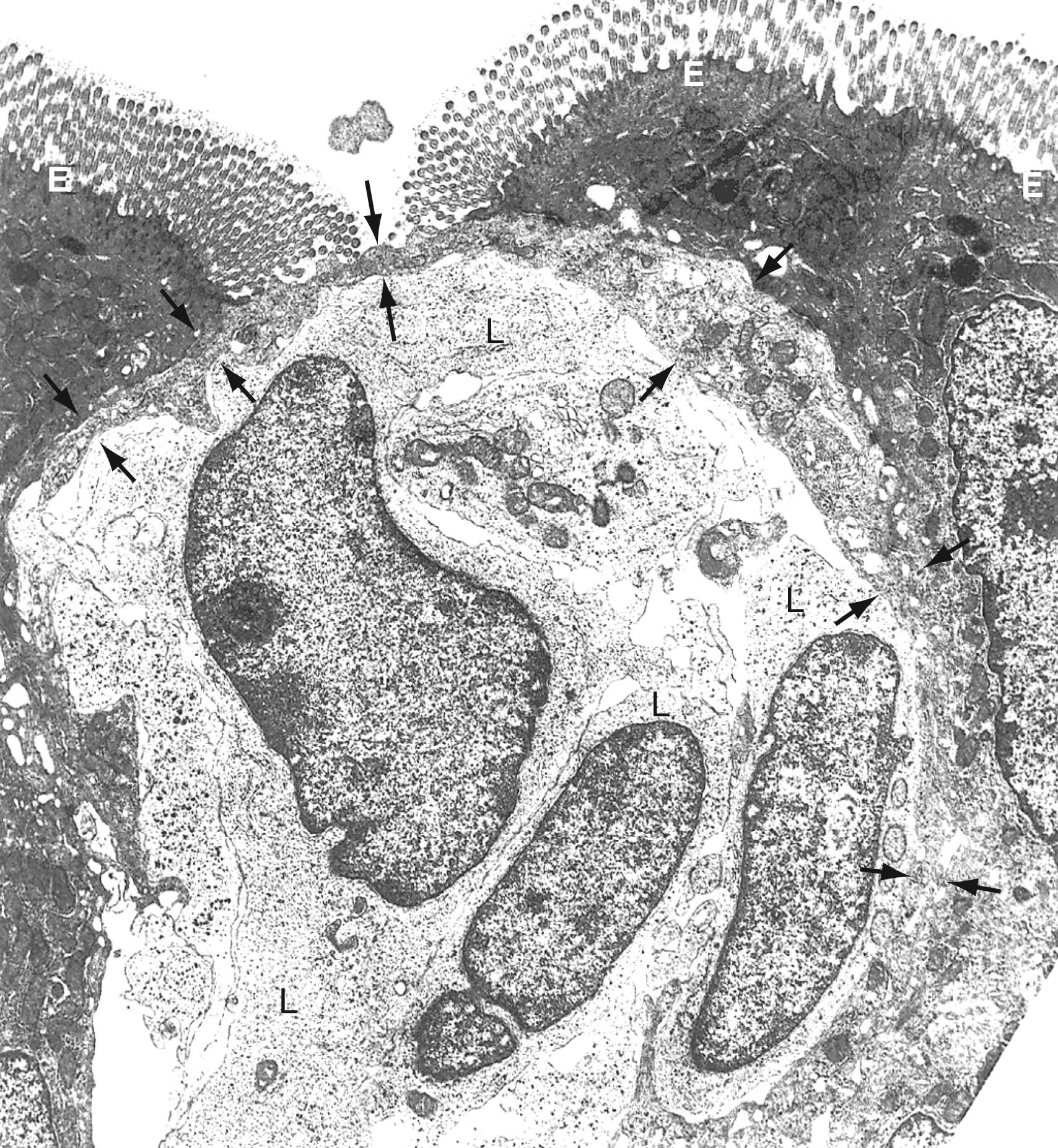 Fig. 2.4, M cell. Transmission electron micrograph from noncolumnar region of a Peyer patch epithelium shows a cross-sectional view of a microfold (M) cell, as well as associated microvillus-covered intestinal epithelial cells and at least 3 lymphoid cells (L) . Note the attenuated cytoplasm of the M cell (between arrows) that bridges the surface between microvillus-covered epithelial cells, forming tight junctions with them and producing a barrier between lymphoid cells and the intestinal lumen (×9600). B, B cell; E, intestinal epithelial cell.