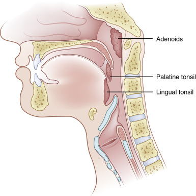 FIGURE 13-3, Waldeyer ring. Although the adenoids and lingual tonsils are basically midline structures, the palatine tonsils are found bilaterally framed by the pharyngeal faucial arches.