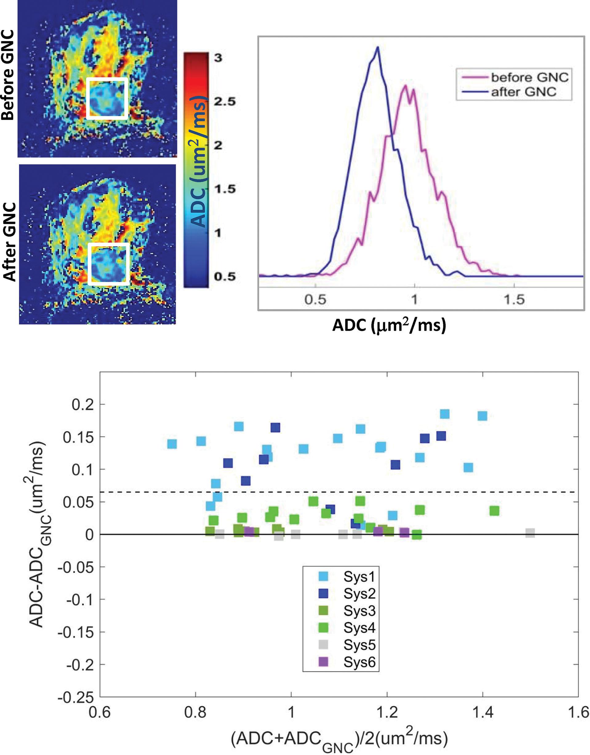 Fig. 14.2, Gradient system-dependent ADC bias for multiscanner breast DWI study.