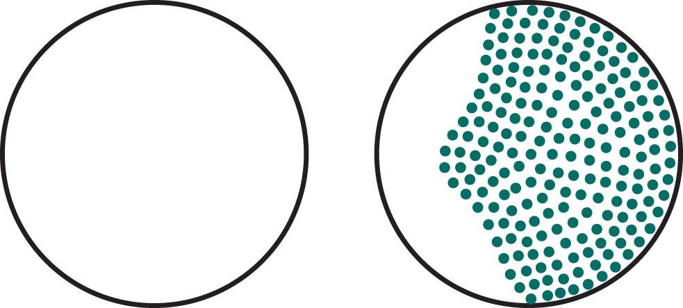 Fig. 15.2, Optic or retrobulbar neuritis causes an irregular area of visual loss (scotoma) in the affected eye.