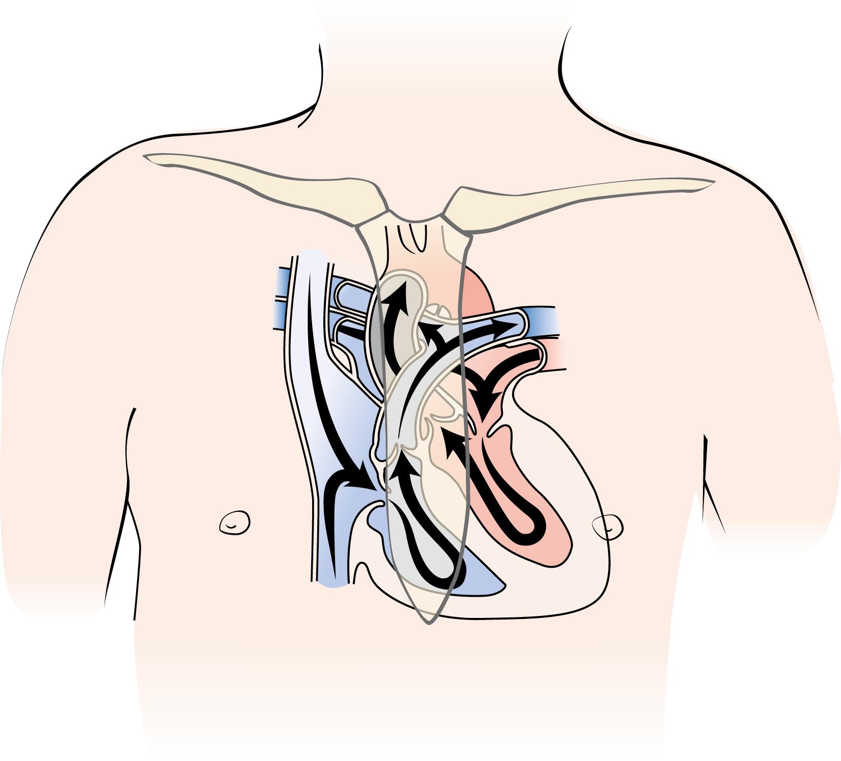 Fig. 9.1, Location of the heart within the thorax. The right atrium and right ventricle lie immediately beneath the sternum. The left atrium lies posteriorly against the spine. The left ventricle extends laterally toward the chest wall, whereas the left ventricular outflow tract extends to the right side of the sternum, going up toward the cardiac base.