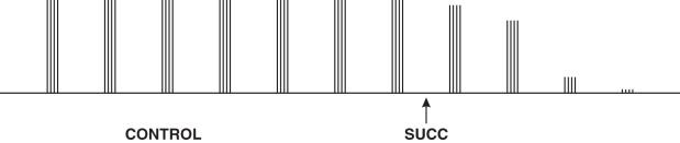 Fig. 8.5, The train-of-four twitch response recorded before (CONTROL) and after a dose of suxamethonium. Before administration of suxamethonium 1 mg kg –1 , four twitches of equal height are visible. After giving the drug (SUCC), the heights of all four twitches decrease equally; no fade of the train-of-four is seen. Within 1 min, the trace has been ablated.