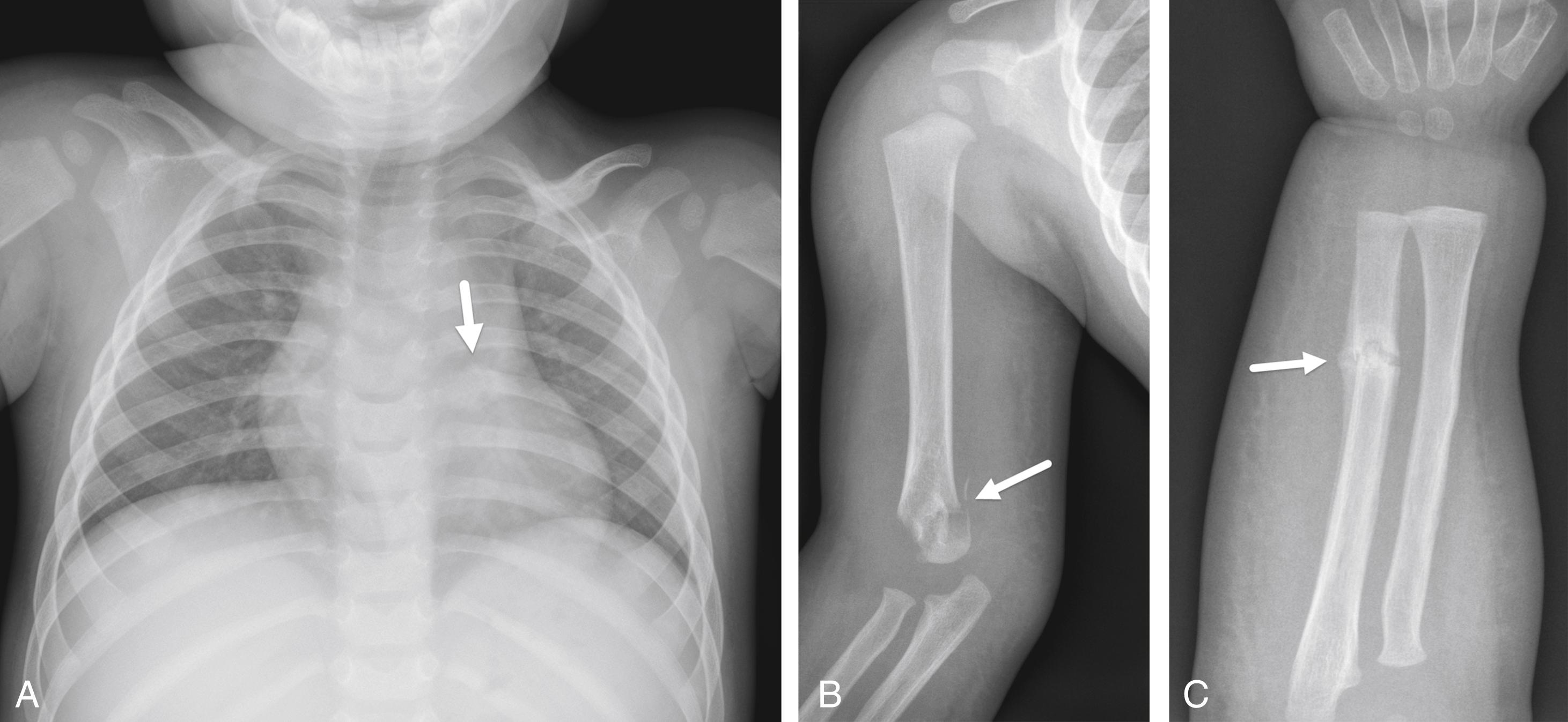 FIGURE 7-48, Child abuse.