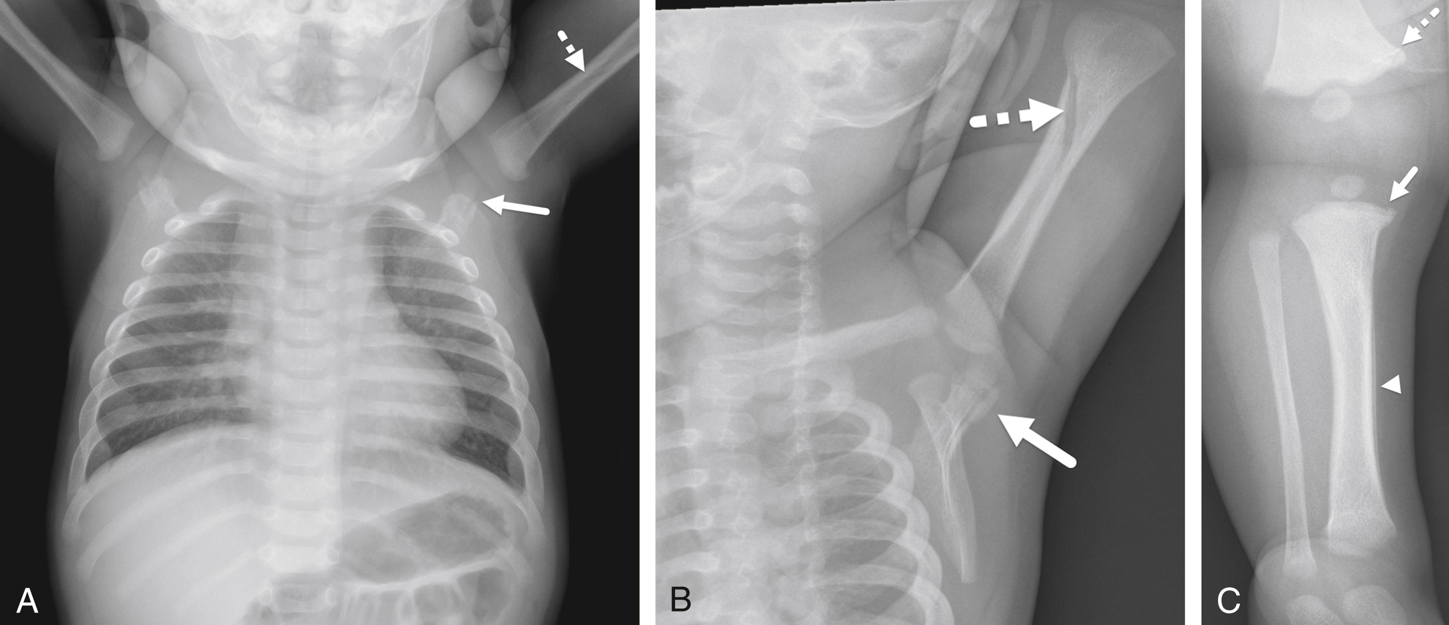 FIGURE 7-49, Child abuse.