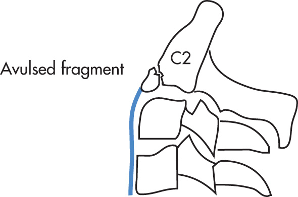 FIG. 5.13