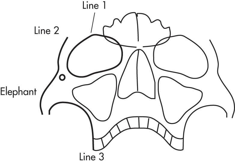 FIG. 5.25