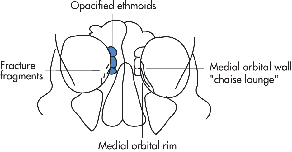 FIG. 5.27