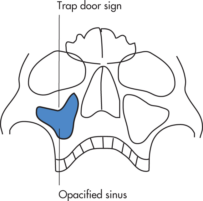 FIG. 5.28