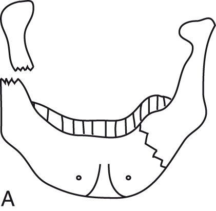 FIG. 5.31