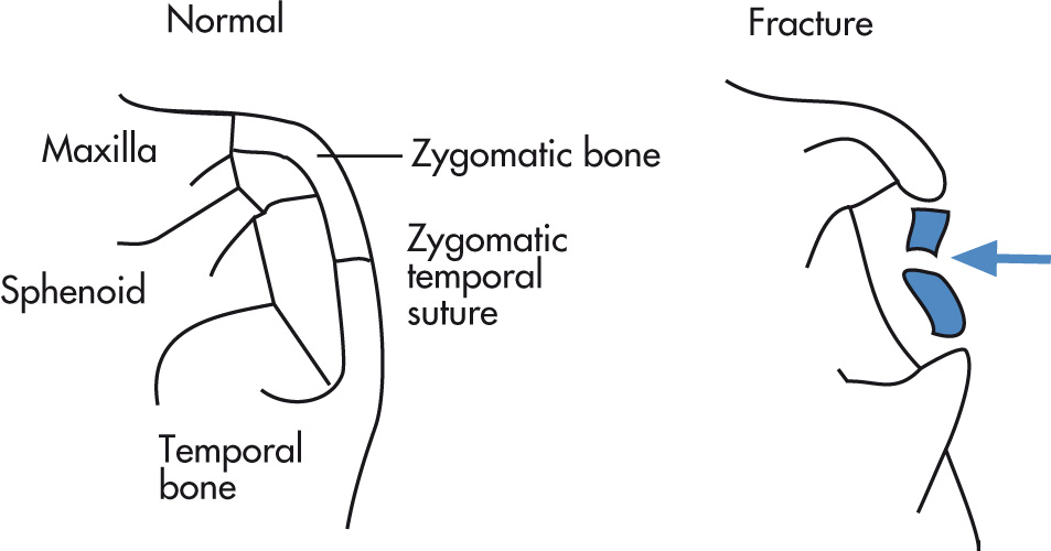 FIG. 5.32