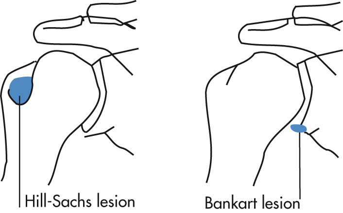 FIG. 5.39