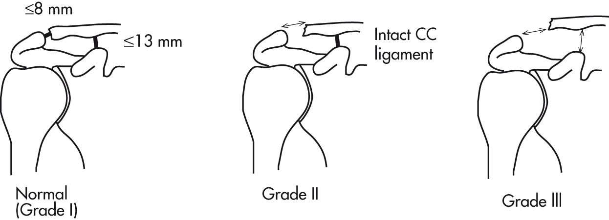 FIG. 5.45