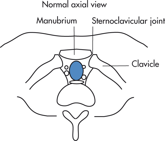 FIG. 5.46