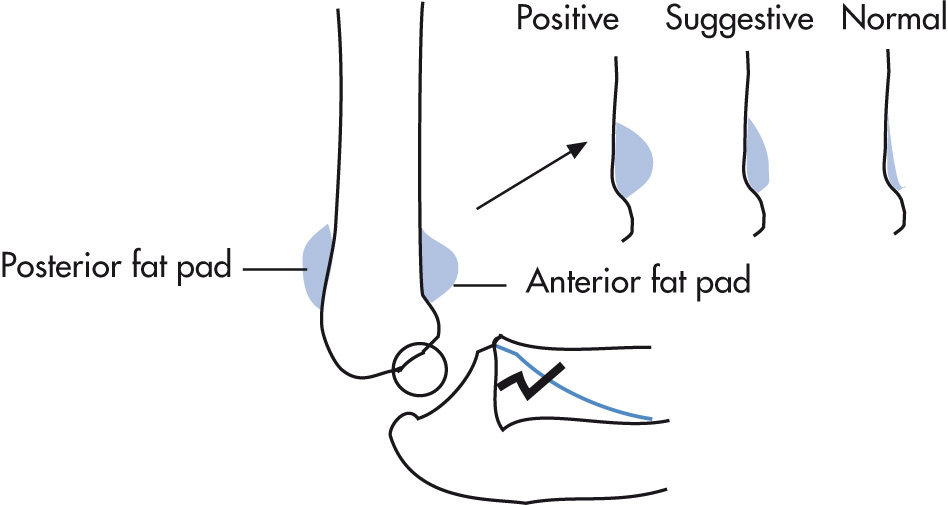 FIG. 5.50