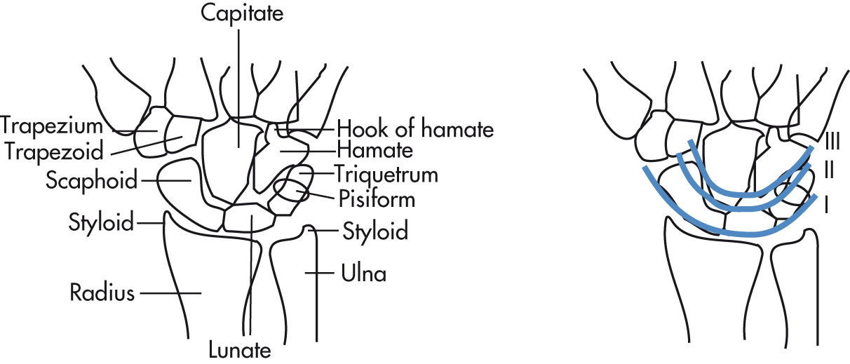 FIG. 5.56