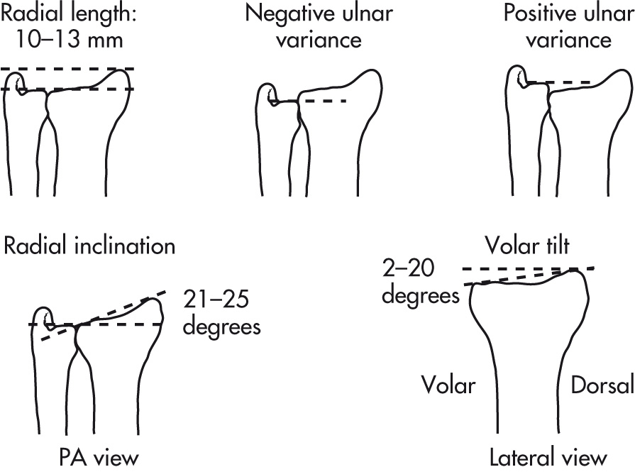 FIG. 5.57