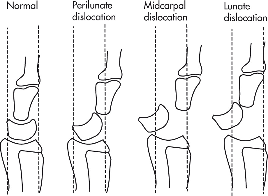 FIG. 5.58