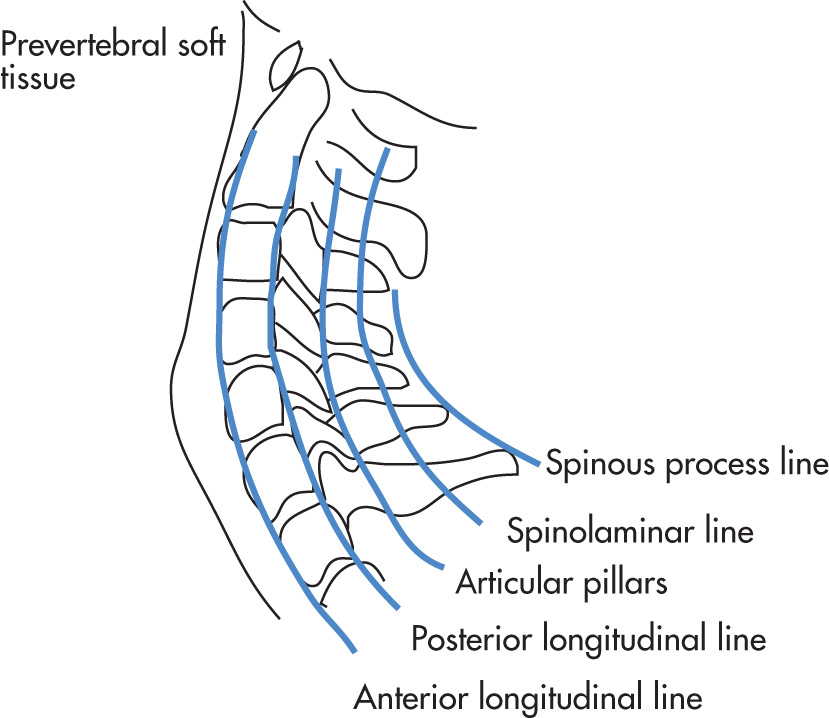 FIG. 5.6