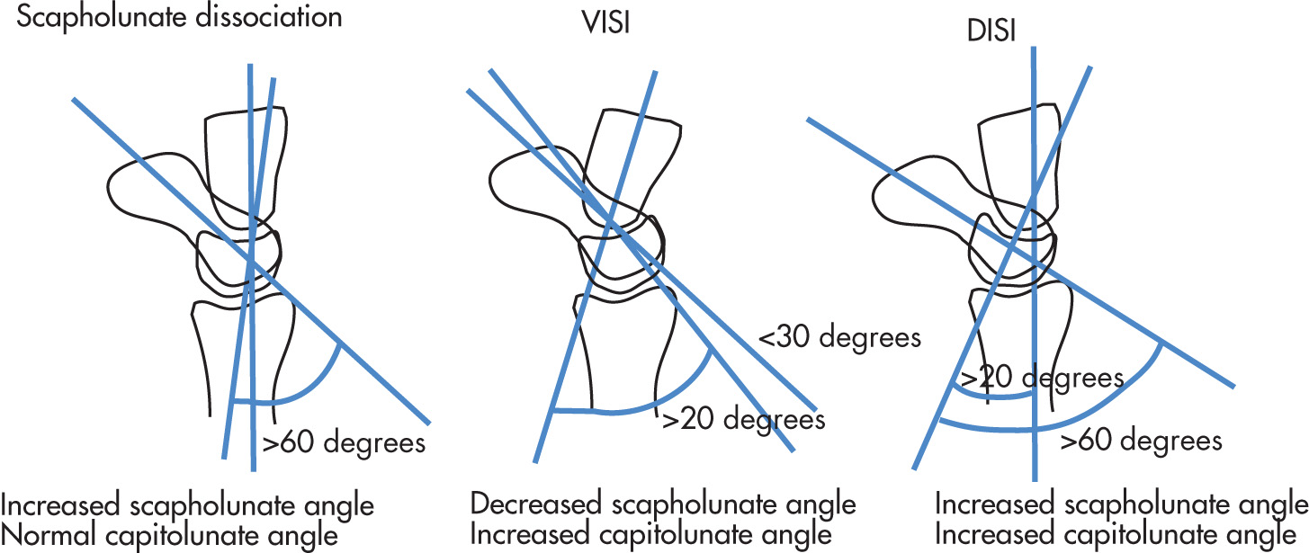 FIG. 5.61