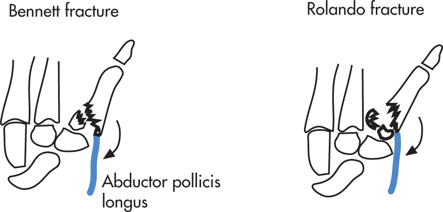 FIG. 5.64