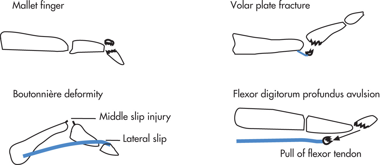 FIG. 5.67