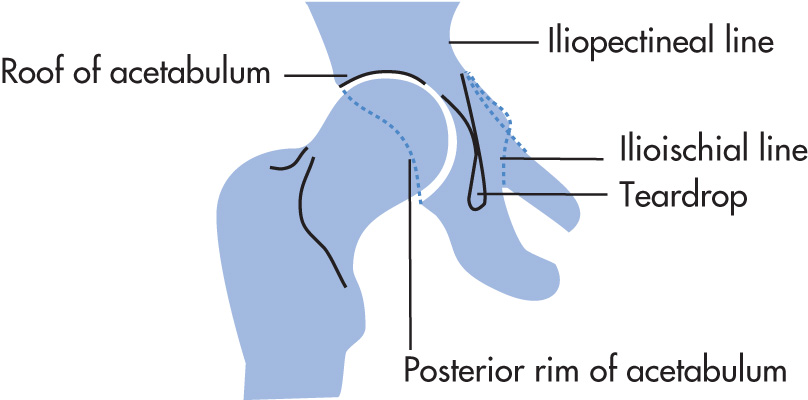 FIG. 5.68