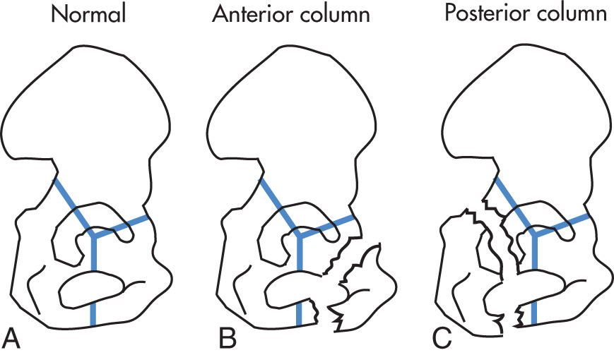 FIG. 5.71