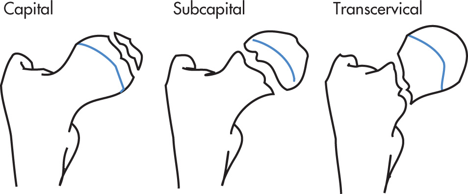 FIG. 5.73