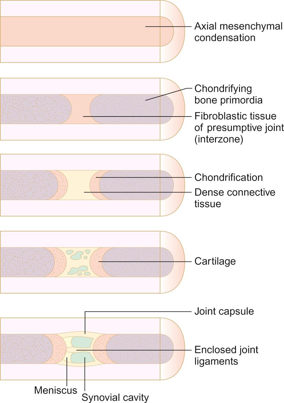 Fig. 27.1, Synovial joint formation. Mesenchymal condensation forms the limb long bones. The joint capsule, cartilage and ligaments arise from the interzone region.