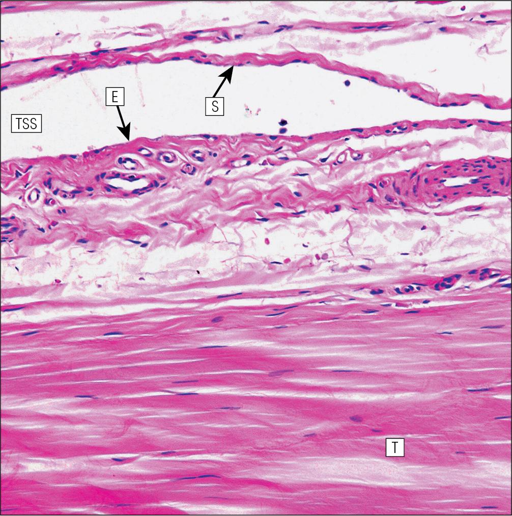 Fig. 13.11, Tendon Sheath.