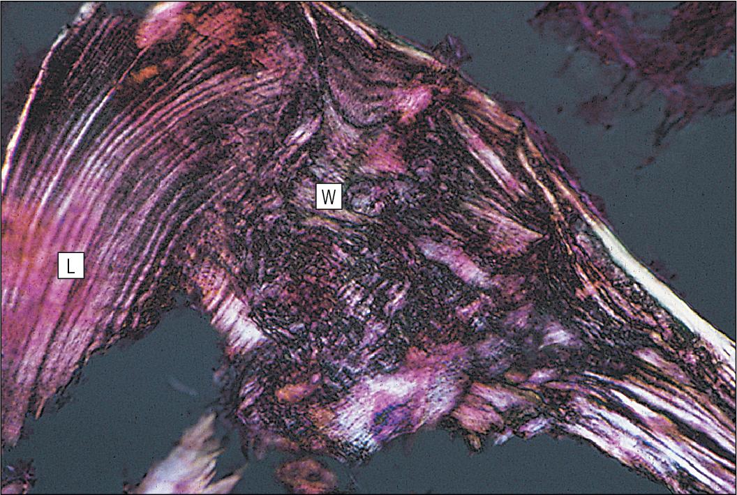 Fig. 13.13, Woven and Lamellar Bone.