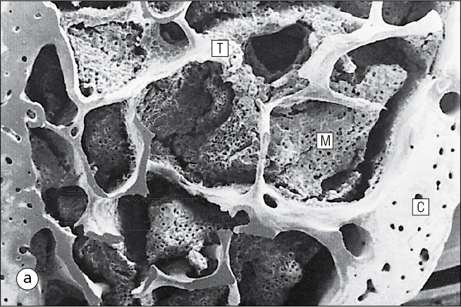 Fig. 13.14, Bone Architecture: Cortical and Trabecular Bone.