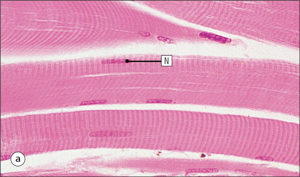 Fig. 13.2, Skeletal Muscle Fibres.