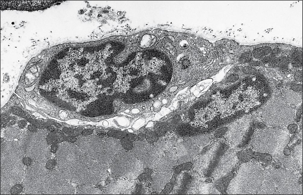 Fig. 13.5, Satellite Cells.