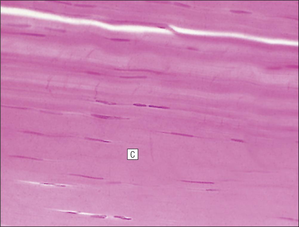 Fig. 13.9, Tendon.