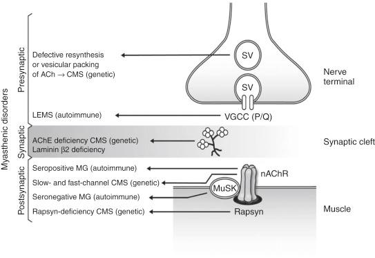 Fig. 14.1, Myasthenic disorders.