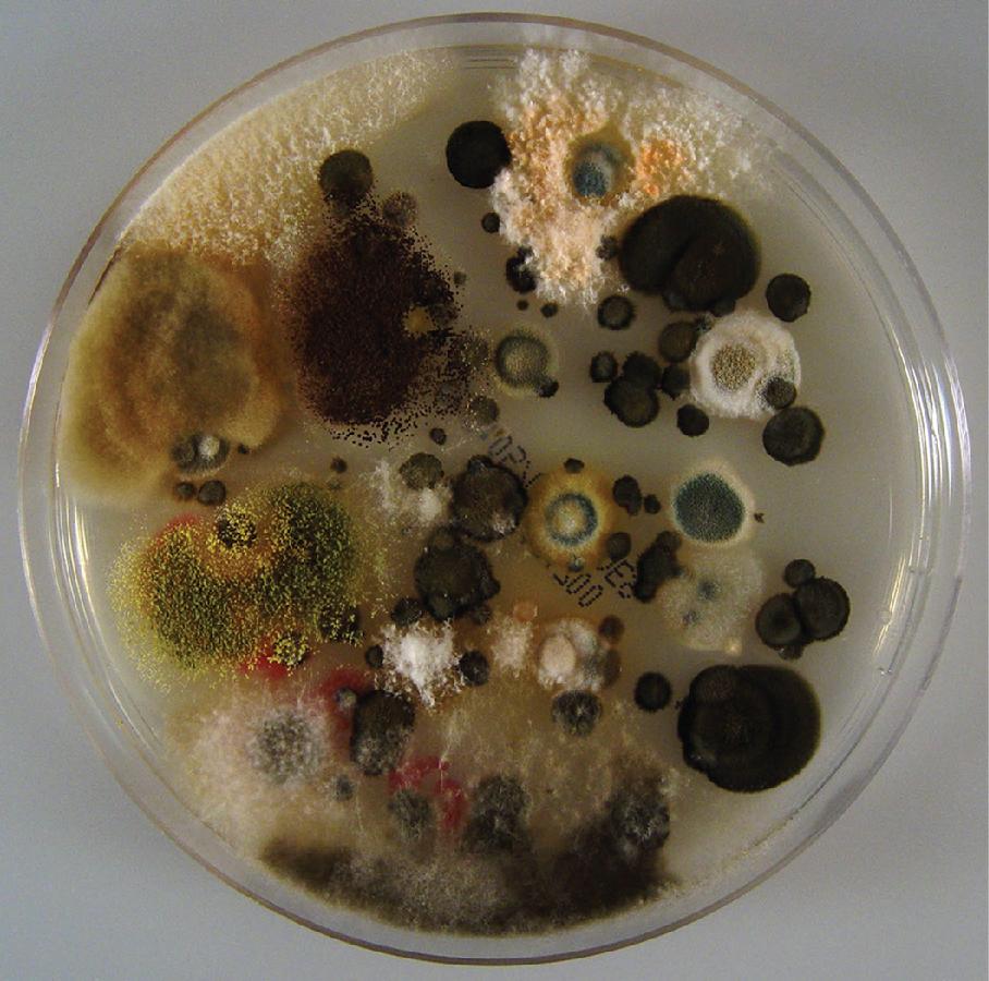 FIGURE 87.1, Numerous colonies of diverse environmental fungi on a culture plate that was placed on a windowsill near an open window for a few hours.