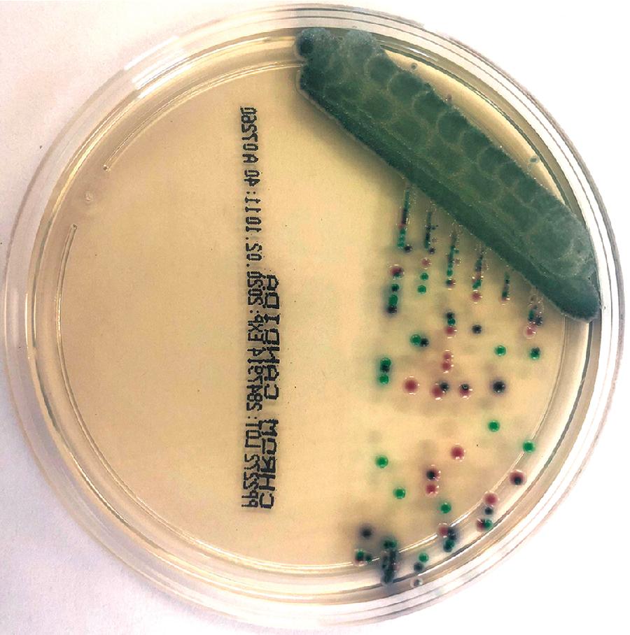 FIGURE 87.9, Culture of mixed yeast species on a chromogenic medium. Species-specific colors may differ among agar brands, and manufacturer’s instructions must be consulted for correct interpretation. Polyfungal yeast growth may be difficult to detect on nonchromogenic media.