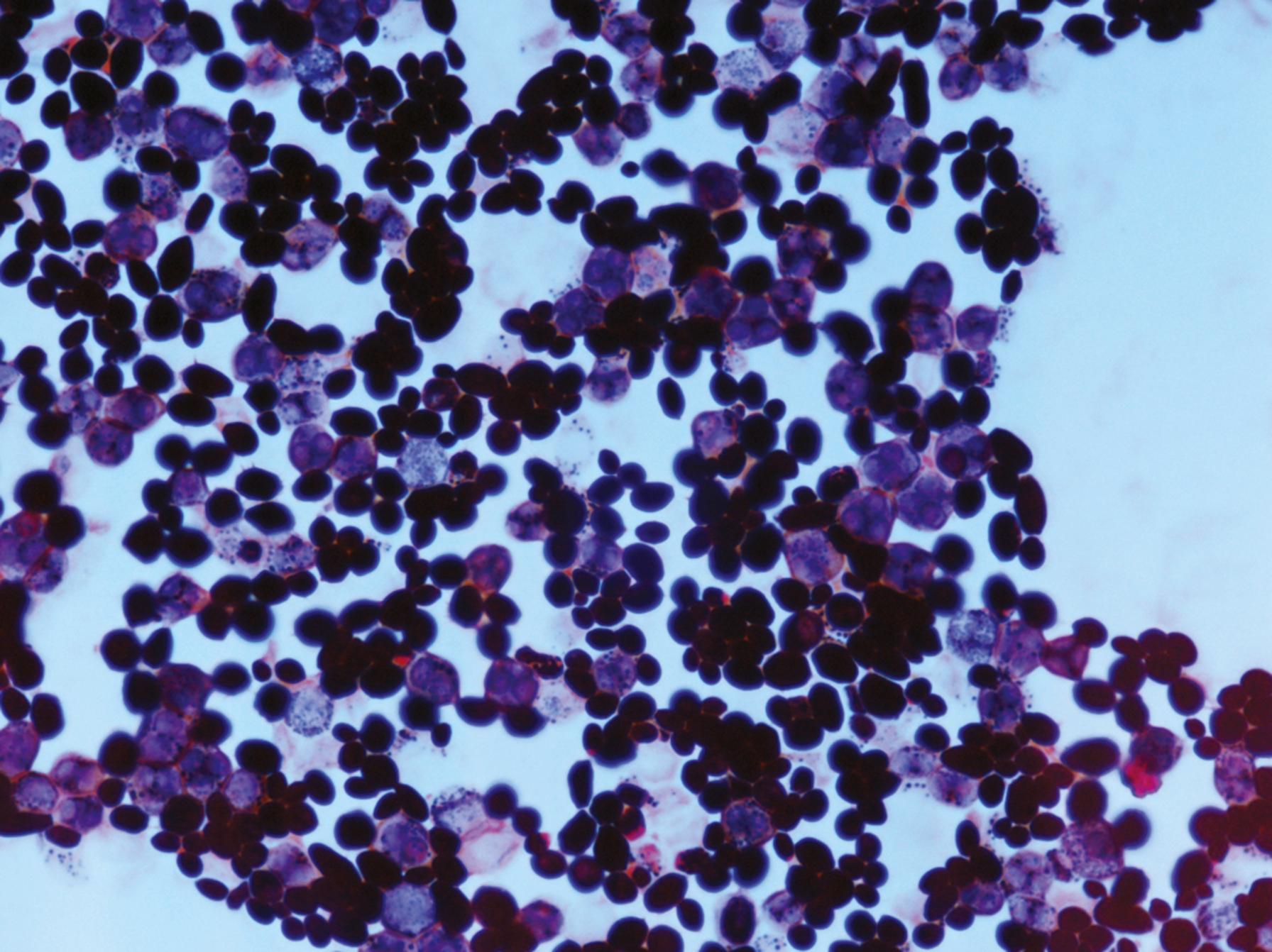 Fig. 60.12, Ascospores with asci (pale staining) along with budding yeast cells of Saccharomyces cerevisiae.