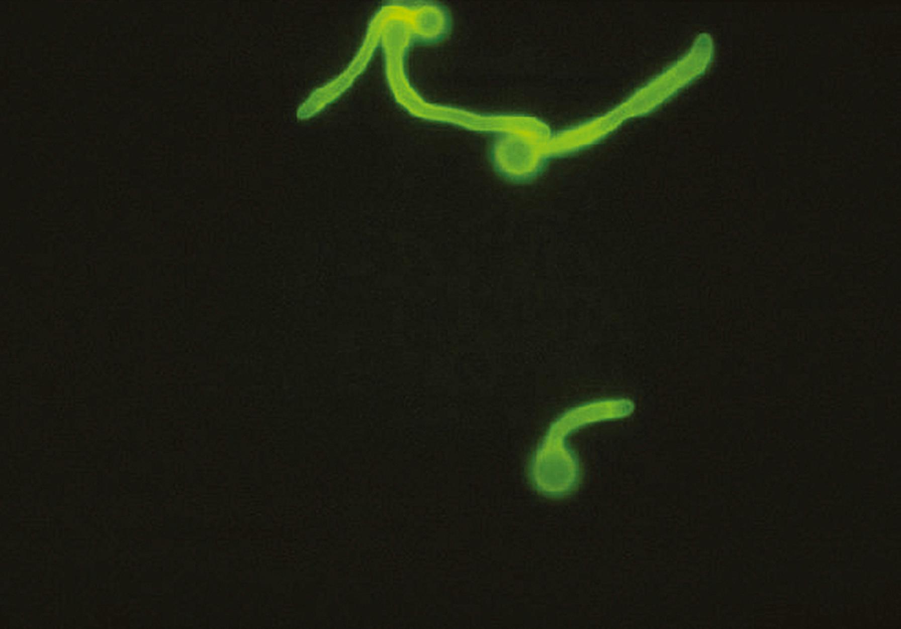 Fig. 60.15, Calcofluor white stain of Candida albicans in culture. When viewed with a fluorescence microscope, the chitinous walls of the fungus will fluoresce. Germ tubes shown are produced following incubation of the yeast in serum.